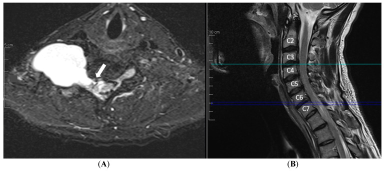 Key image 3