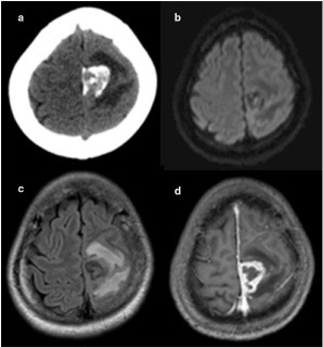 Key image 2