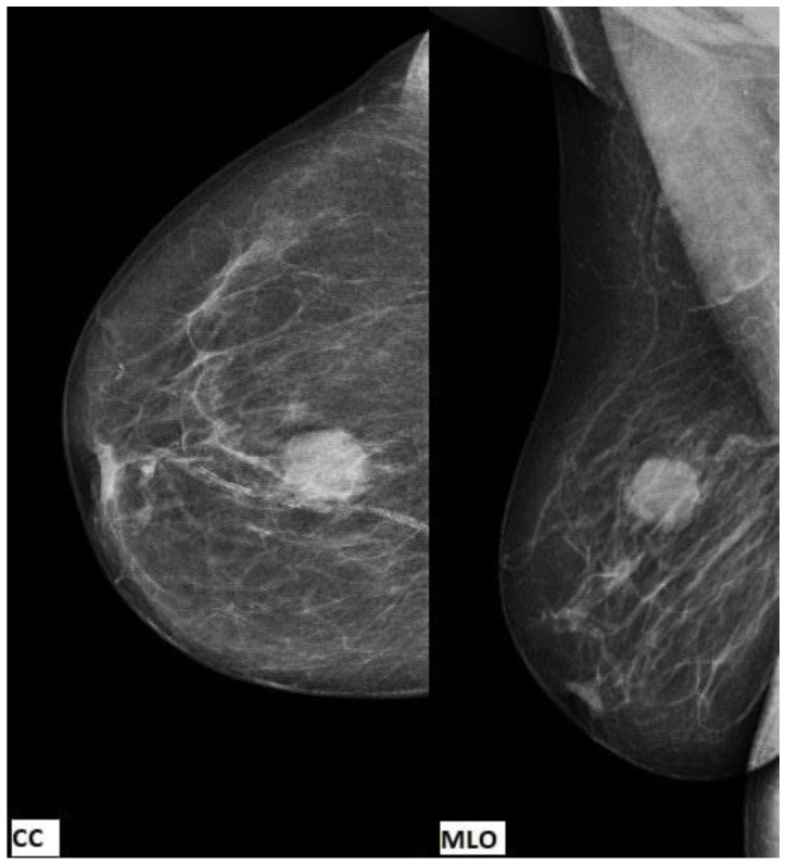 Key image 1