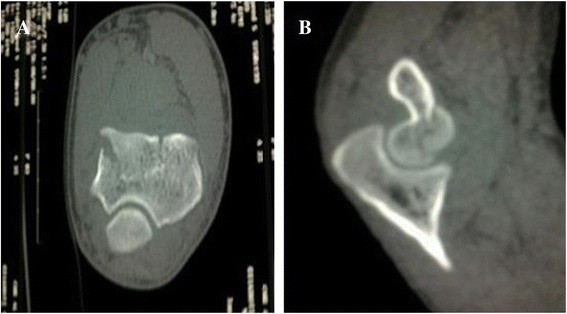 Key image 2