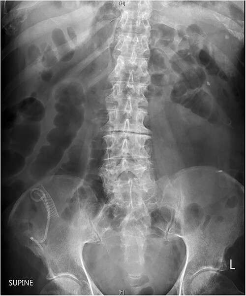 Key image 3