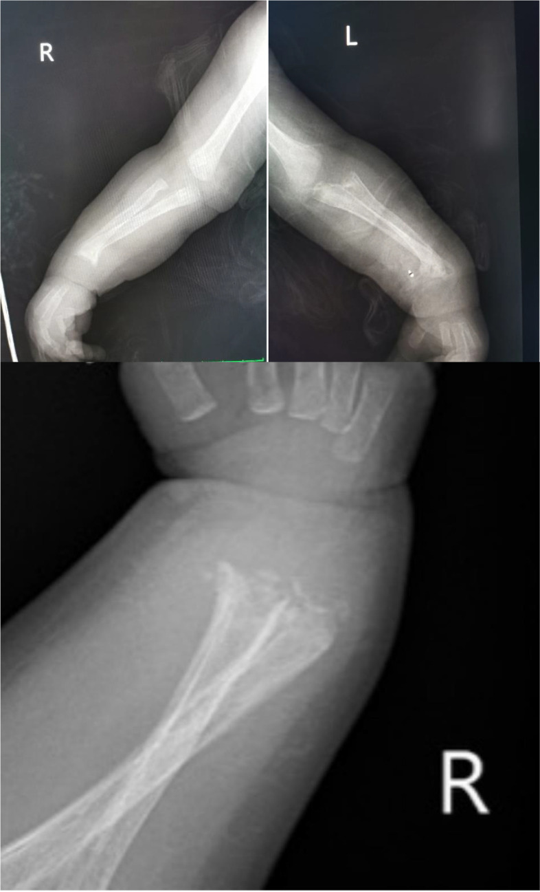 Key image 1