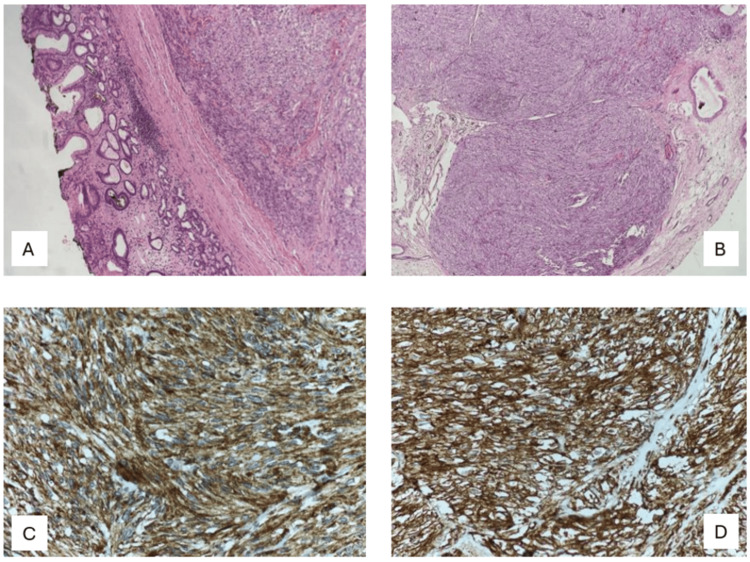 Key image 3