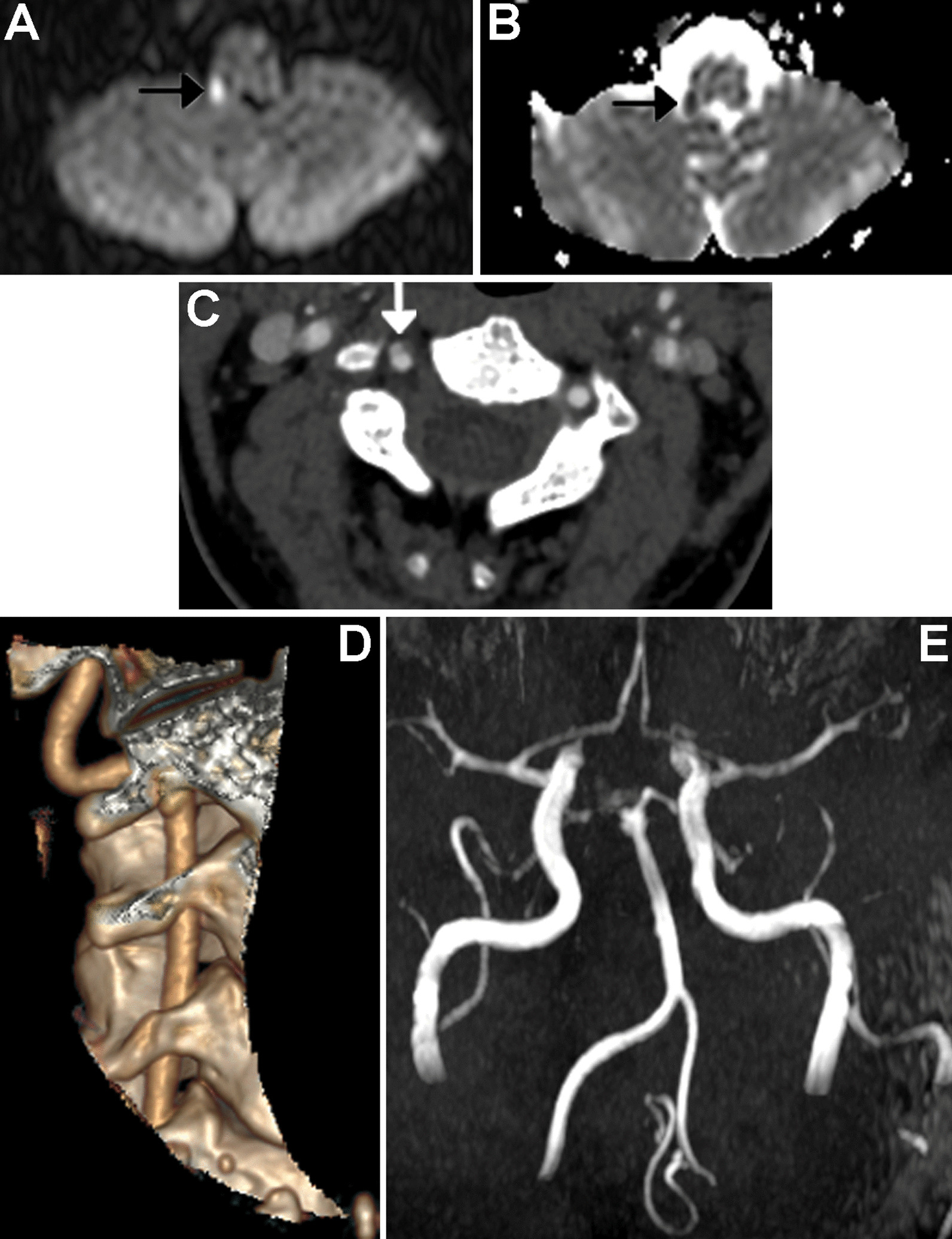 Key image 1