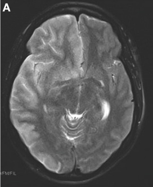 Key image 1