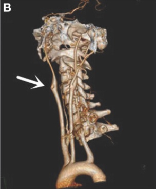Key image 2