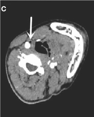 Key image 3