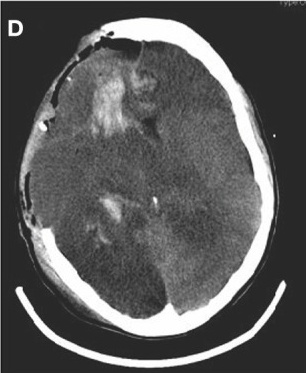 Key image 4