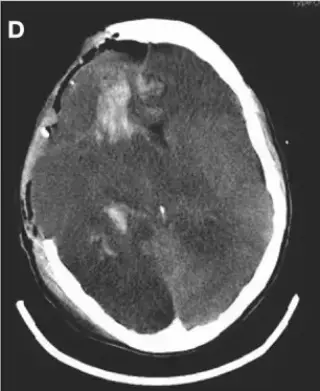 Key image 4