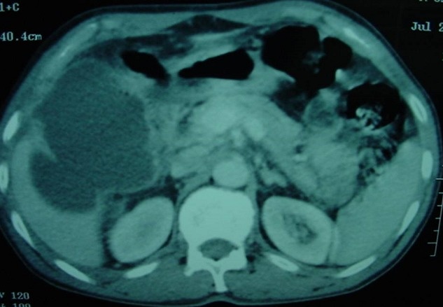 Key image 1