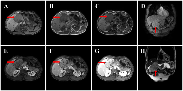 Key image 2