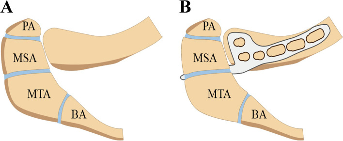 Key image 1
