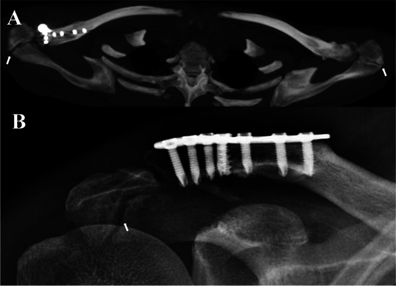 Key image 3