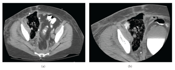 Key image 1
