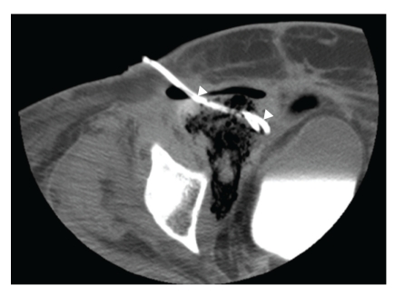 Key image 2