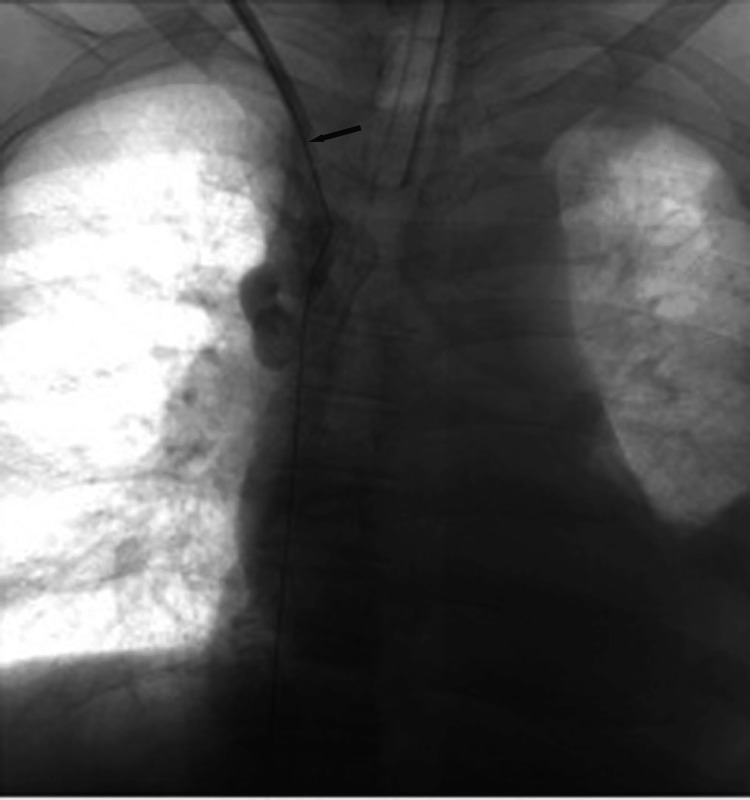 Key image 2
