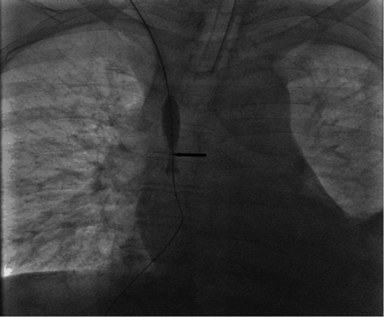 Key image 3