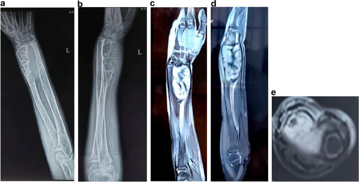 Key image 1