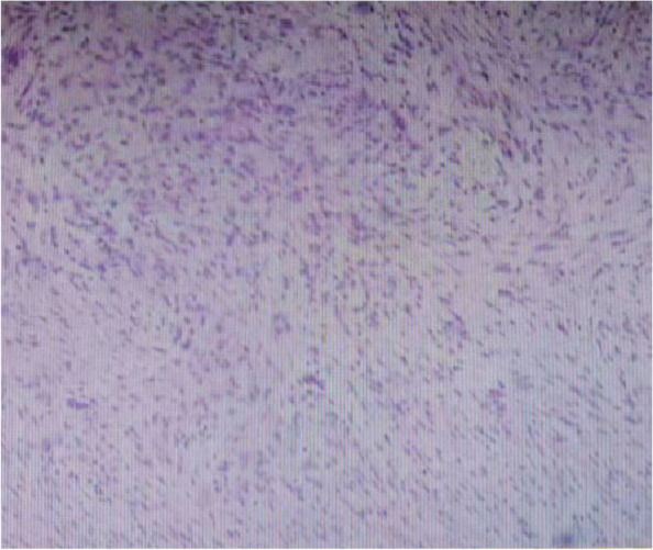 Key image 3