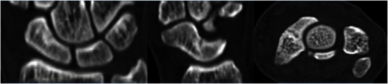 Key image 2