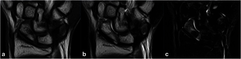 Key image 3