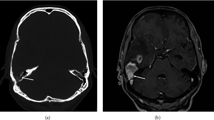 Key image 1