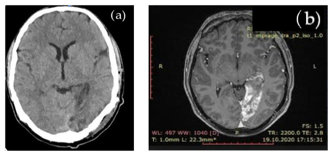 Key image 1