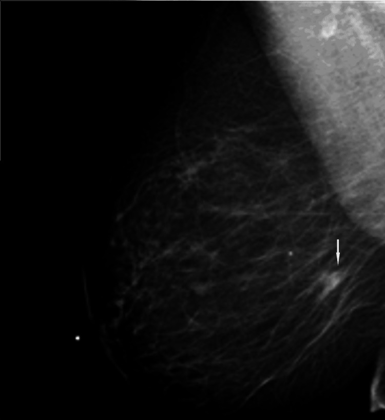 Key image 1