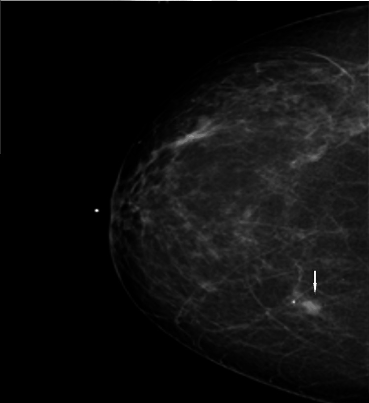 Key image 2