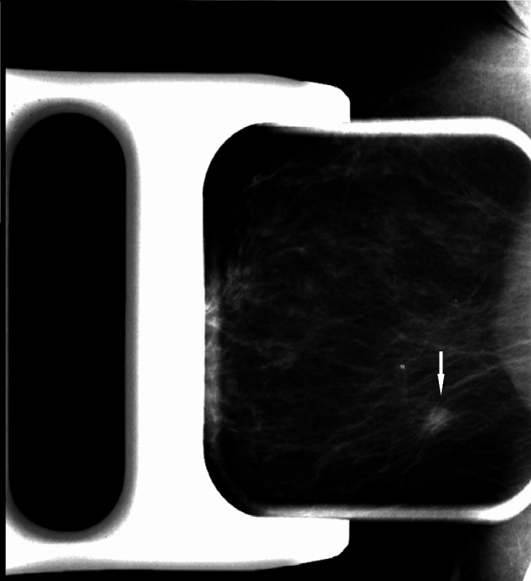 Key image 3
