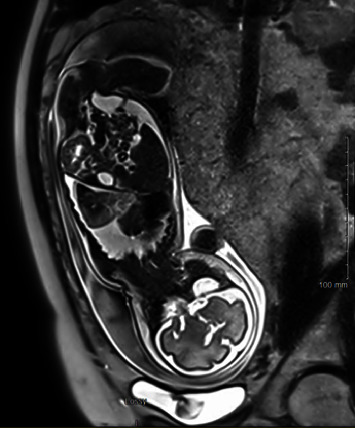Key image 1