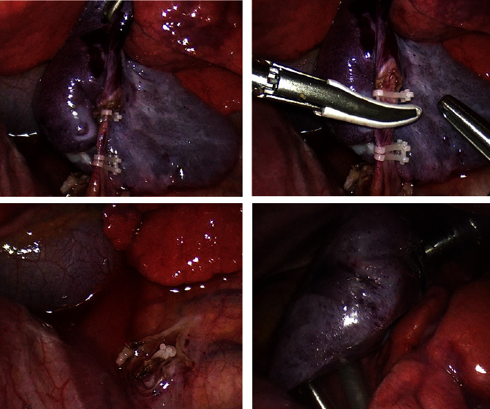 Key image 3