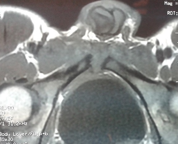 Key image 1