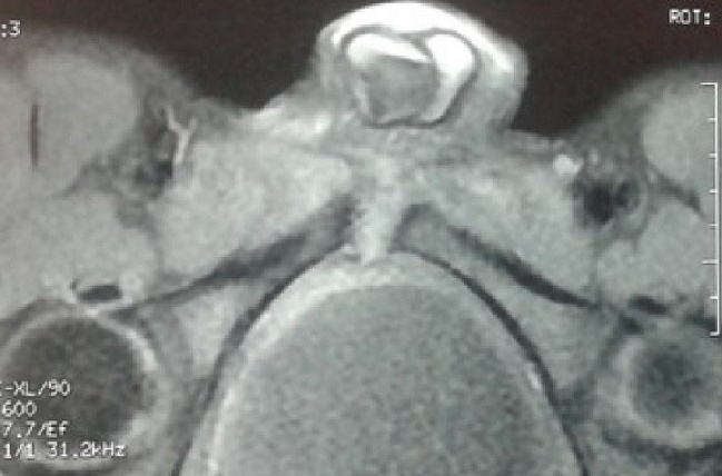 Key image 2
