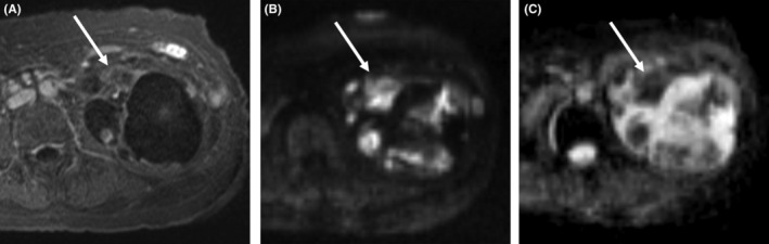 Key image 3