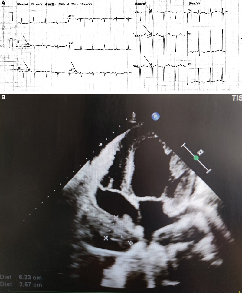 Key image 1