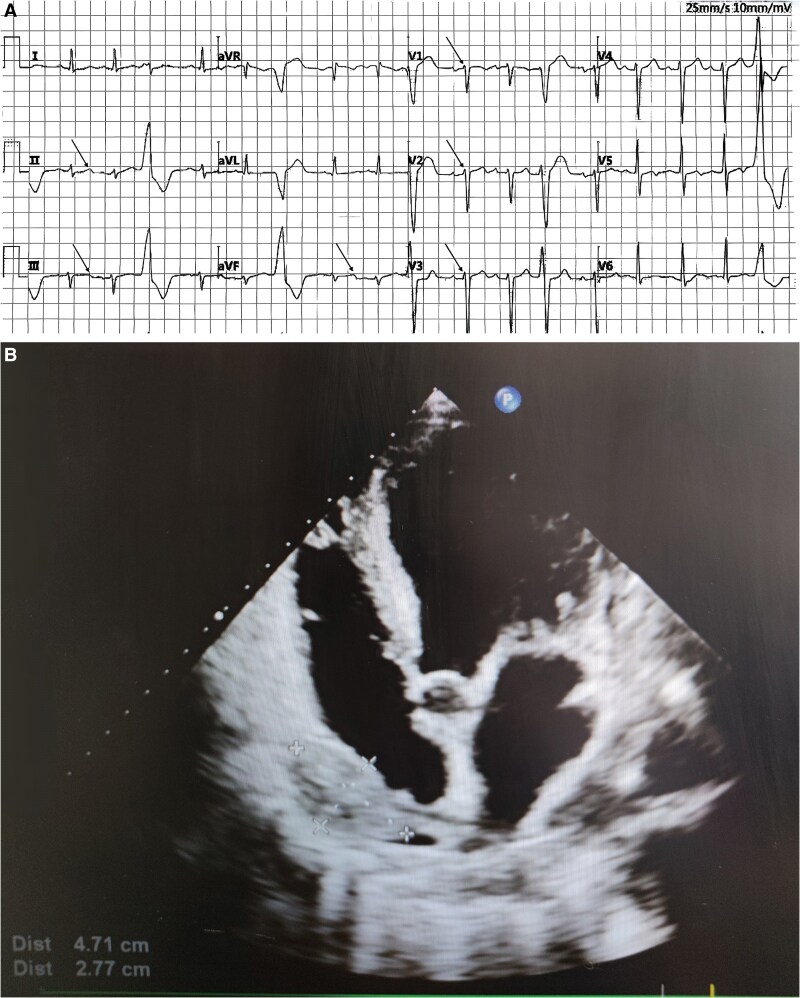 Key image 2