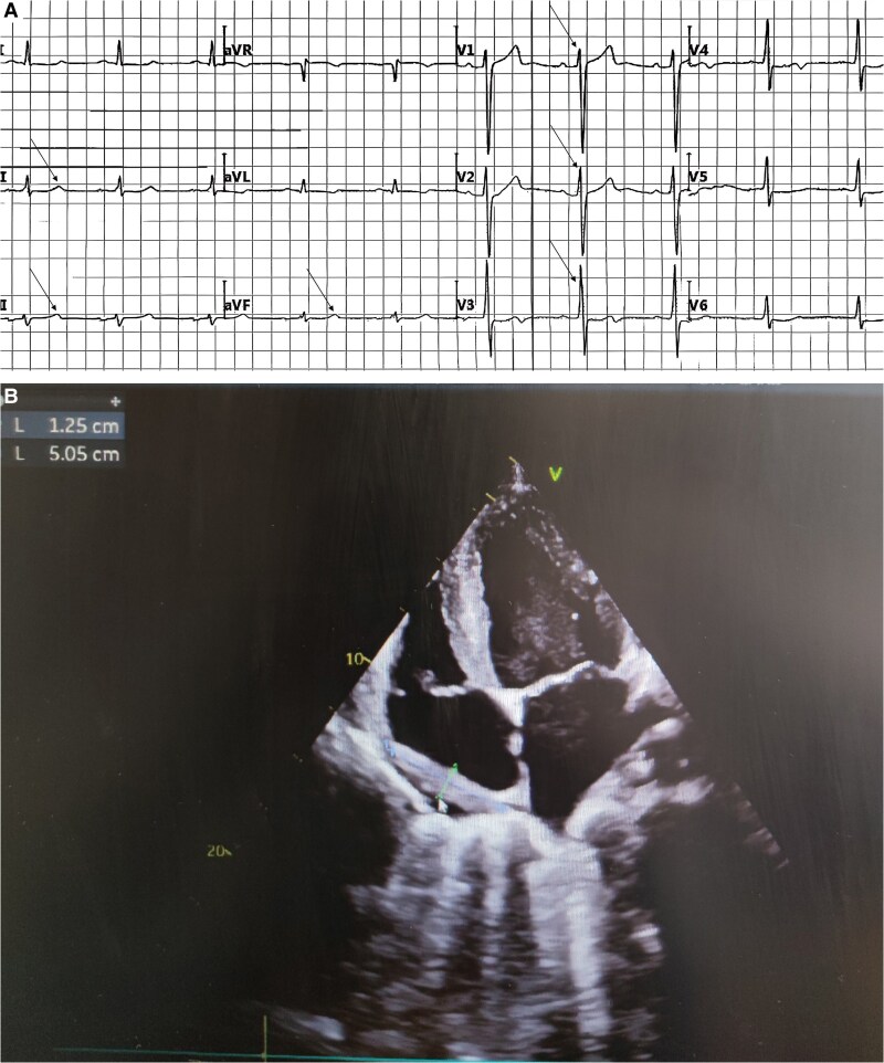 Key image 3