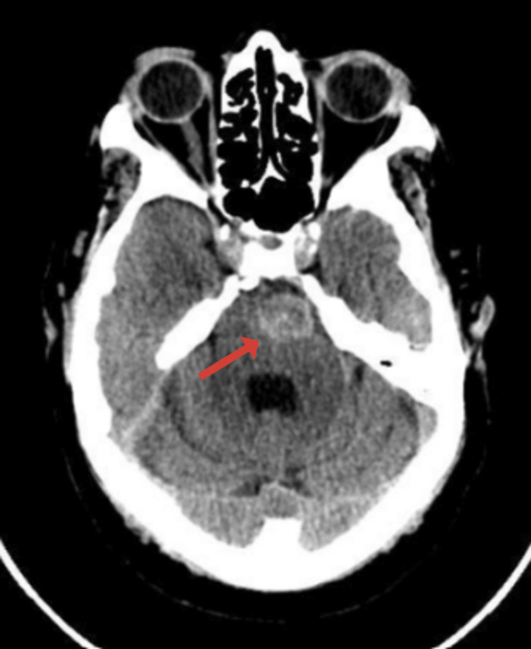 Key image 1