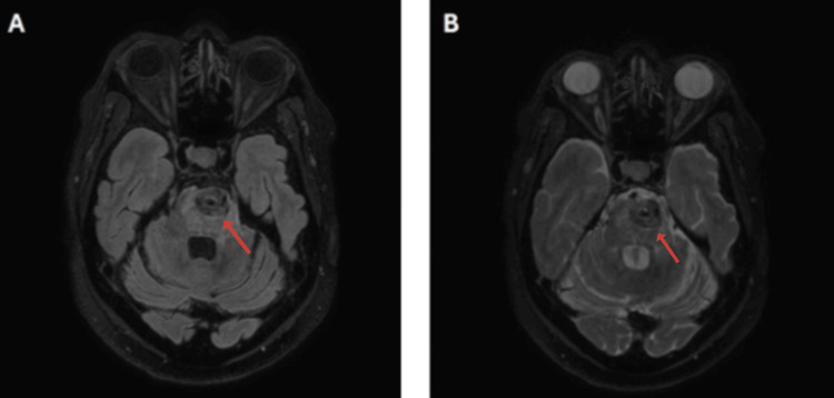 Key image 2