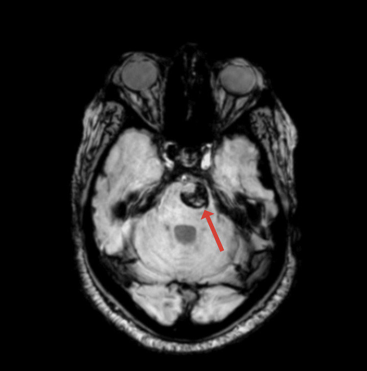 Key image 3