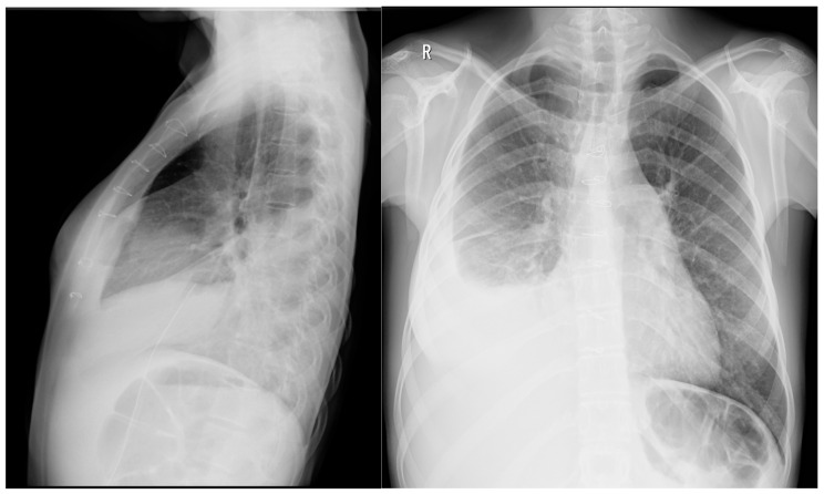Key image 1