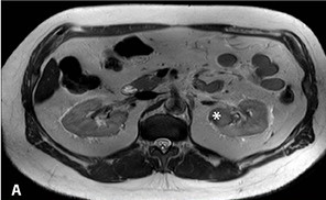 Key image 1