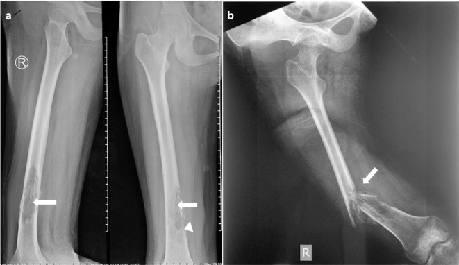 Key image 1