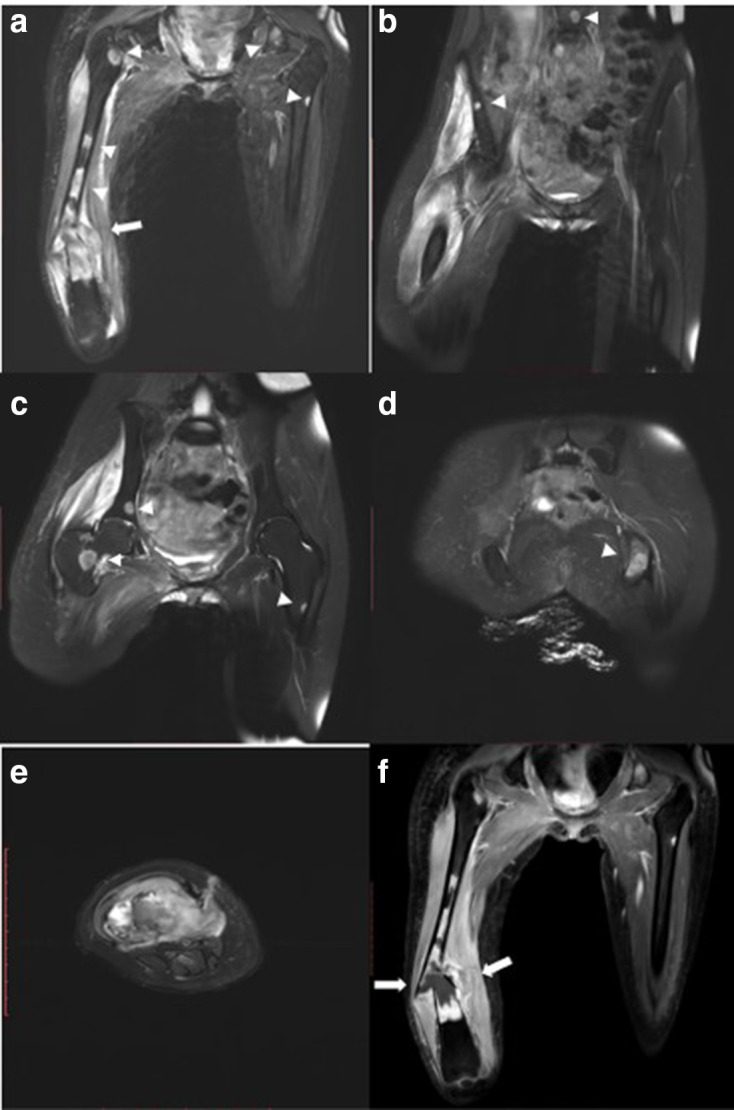 Key image 3