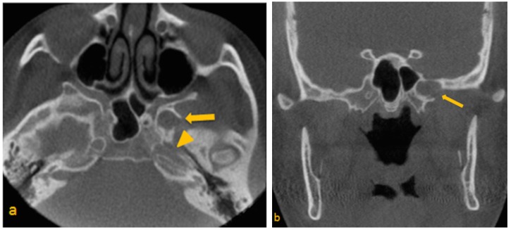 Key image 1