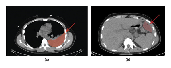 Key image 1