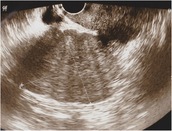Key image 1