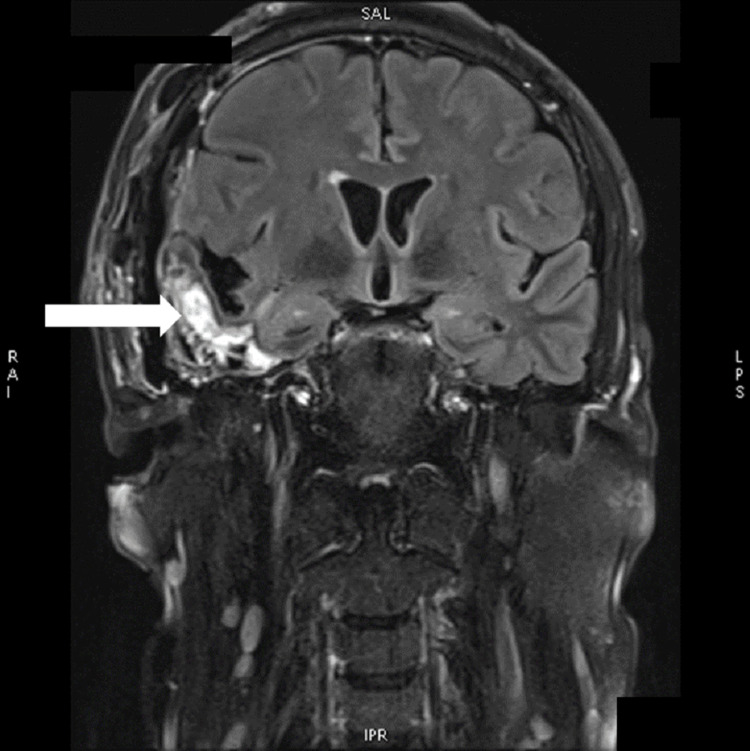 Key image 1