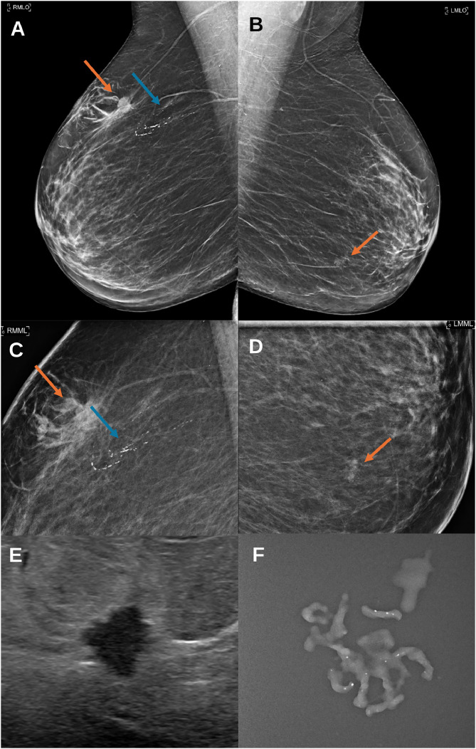 Key image 1